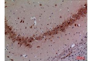 Immunohistochemistry (IHC) analysis of paraffin-embedded Rat Brain, antibody was diluted at 1:100. (Cullin 4B antibody  (Internal Region))