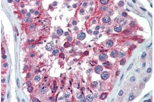 Immunohistochemistry (Paraffin-embedded Sections) (IHC (p)) image for anti-Lin-28 Homolog A (C. Elegans) (LIN28A) (N-Term) antibody (ABIN6741558)