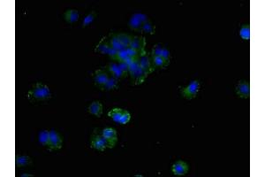 Immunofluorescent analysis of MCF-7 cells using ABIN7169856 at dilution of 1:100 and Alexa Fluor 488-congugated AffiniPure Goat Anti-Rabbit IgG(H+L) (SMIM19 antibody  (AA 44-107))