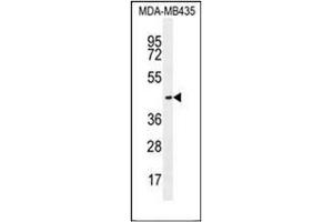Western blot analysis of OR2L13 Antibody (C-term) in MDA-MB435 cell line lysates (35ug/lane).