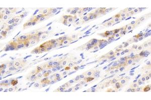 Detection of SCGN in Mouse Stomach Tissue using Polyclonal Antibody to Secretagogin (SCGN) (SCGN antibody  (AA 1-276))