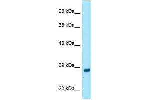 WB Suggested Anti-RAB4A Antibody Titration: 1. (Rab4 antibody  (C-Term))