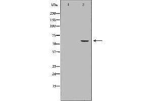 Western blot analysis of Hela whole cell lysates, using BMPR1A Antibody.