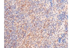 ABIN6267288 at 1/100 staining rat spleen tissue sections by IHC-P.