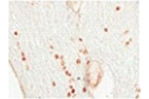 Sample Type: Human Optic Nerve and Spinal CordCellular Target: Oligoden Drocyte Lineage CellsDilution: 1:500 (OLIG2 antibody  (N-Term))