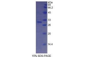SDS-PAGE analysis of Human Complement Factor I Protein. (Complement Factor I Protein (CFI))