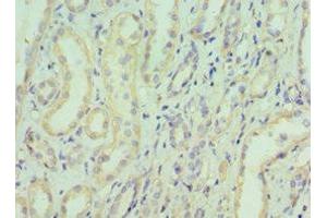 Immunohistochemistry of paraffin-embedded human kidney tissue using ABIN7152153 at dilution of 1:100 (EIF3E antibody  (AA 1-445))
