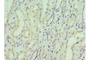 Immunohistochemistry of paraffin-embedded human kidney tissue using ABIN7152153 at dilution of 1:100 (EIF3E antibody  (AA 1-445))