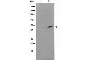 Western blot analysis on COLO205 cell lysate using DOK6 Antibody，The lane on the left is treated with the antigen-specific peptide. (DOK6 antibody  (Internal Region))