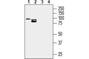 Western blot analysis of mouse BV-2 microglia cell line (lanes 1 and 3) and human HMC3 microglia cell line (lanes 2 and 4) lysates: - 1,2. (CD39 antibody  (Extracellular Loop))