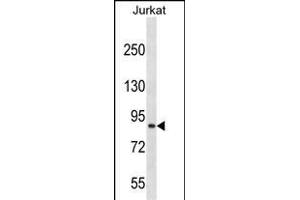 CUL4A Antibody (N-term) (ABIN657794 and ABIN2846767) western blot analysis in Jurkat cell line lysates (35 μg/lane). (Cullin 4A antibody  (N-Term))
