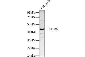 Western blot analysis of extracts of Rat brain, using (ABIN7267984) at 1:1000 dilution. (IL11RA antibody)