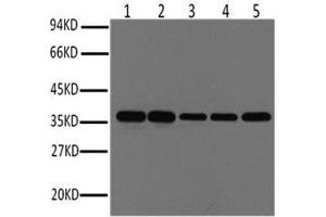 Western Blot analysis of Hela, Rat brain, Rabbit muscle, Sheep muscle, Mouse brain using GAPDH Monoclonal Antibody at dilution of 1:1000. (GAPDH antibody)