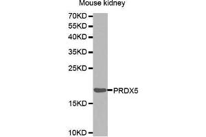 Western Blotting (WB) image for anti-Peroxiredoxin 5 (PRDX5) (AA 53-214) antibody (ABIN6216418) (Peroxiredoxin 5 antibody  (AA 53-214))