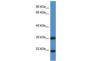 Western Blot showing CLIC3 antibody used at a concentration of 1.
