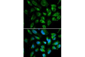 Immunofluorescence analysis of HepG2 cell using KIR2DL3 antibody. (KIR2DL3 antibody  (AA 22-245))