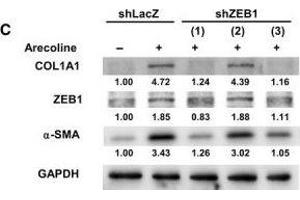 Western Blotting (WB) image for anti-Glyceraldehyde-3-Phosphate Dehydrogenase (GAPDH) antibody (ABIN2857072)