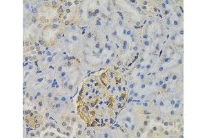 Immunohistochemistry (Paraffin-embedded Sections) (IHC (p)) image for anti-Fms-Related tyrosine Kinase 3 (FLT3) antibody (ABIN7012052)