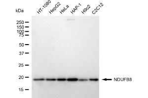Western blotting analysis using NDUFB8 antibody (ABIN7799552).