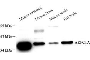 Western blot analysis of ARPC1A (ABIN7072894) at dilution of 1: 400 (ARPC1A antibody)