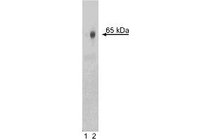 Western blot analysis of NF-kappaB p65 (pS529) in human peripheral blood mononuclear cells (PBMC). (NFkB antibody  (pSer529))
