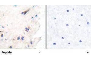 Immunohistochemical analysis of paraffin-embedded human brain tissue using PLCB3 polyclonal antibody . (PLCB3 antibody  (Ser1105))
