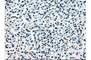 Immunohistochemical staining of paraffin-embedded colon tissue using anti-MAP2K4mouse monoclonal antibody. (MAP2K4 antibody)