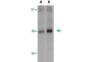 Western blot analysis of SQSTM1 in human spleen tissue lysate with SQSTM1 polyclonal antibody  at (A) 1 and (B) 2 ug/mL .