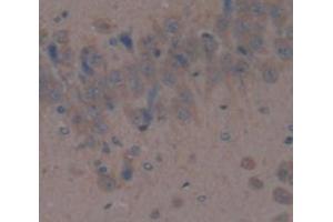 Figure. (DPP4 antibody  (AA 638-767))