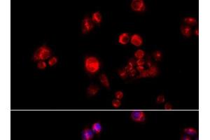 Immunofluorescence analysis of HeLa cells using GLUD2 Polyclonal Antibody at dilution of 1:100 (40x lens). (GLUD2 antibody)