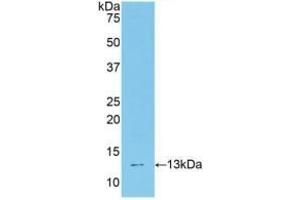 Detection of Recombinant TCF20, Mouse using Polyclonal Antibody to Transcription factor 20 (TCF20) (TCF20 antibody  (AA 1871-1965))