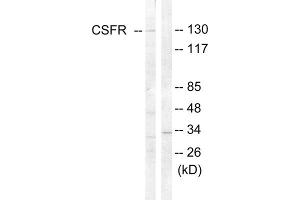 Western blot analysis of extracts from HT-29 cells, using CSFR (epitope around residue 809) antibody. (CSF1R antibody  (Tyr809))