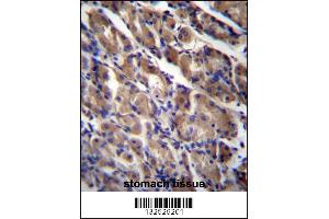 ABRA Antibody immunohistochemistry analysis in formalin fixed and paraffin embedded human stomach tissue followed by peroxidase conjugation of the secondary antibody and DAB staining. (ABRA antibody  (C-Term))