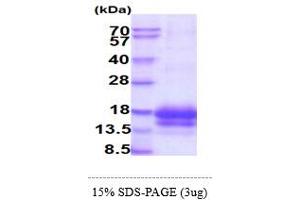 SDS-PAGE (SDS) image for Epithelial Mitogen (EPGN) (AA 23-110) protein (His tag) (ABIN5855016) (Epigen Protein (AA 23-110) (His tag))