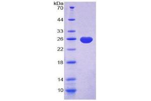 SDS-PAGE (SDS) image for Orosomucoid 1 (ORM1) (AA 20-201) protein (His tag) (ABIN2123976)