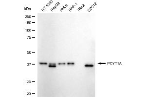 Western blotting analysis using PCYT1A antibody (ABIN7799789). (Recombinant PCYT1A antibody)