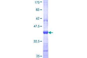 Image no. 1 for Inositol Polyphosphate-5-Phosphatase J (INPP5J) (AA 361-470) protein (GST tag) (ABIN1307959) (INPP5J Protein (AA 361-470) (GST tag))