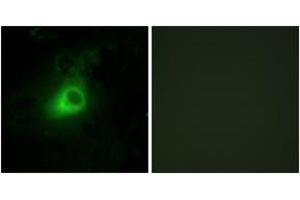 Immunofluorescence (IF) image for anti-G Protein-Coupled Receptor Kinase 6 (GRK6) (AA 10-59) antibody (ABIN2889479) (GRK6 antibody  (AA 10-59))