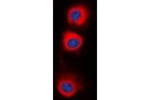 Immunofluorescent analysis of PPP2CA staining in HepG2 cells.