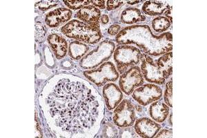 Immunohistochemical staining of human kidney with HISPPD1 polyclonal antibody  shows strong cytoplasmic positivity in cells in tubules while strong nuclear positivity in cells in glomeruli at 1:200-1:500 dilution. (HISPPD1 antibody)