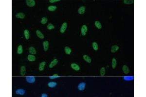 Immunofluorescence (IF) image for anti-Heterogeneous Nuclear Ribonucleoprotein D (HNRNPD) antibody (ABIN7258580)