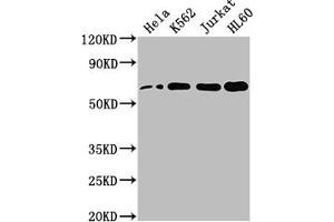 Western Blot Positive WB detected in: Hela whole cell lysate, K562 whole cell lysate, Jurkat whole cell lysate, HL60 whole cell lysate All lanes: HDAC1 antibody at 1:2000 Secondary Goat polyclonal to rabbit IgG at 1/50000 dilution Predicted band size: 56 kDa Observed band size: 60 kDa (Recombinant HDAC1 antibody)