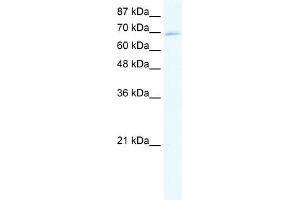 WB Suggested Anti-ZINC FINGER PROTEIN 750 Antibody Titration:  5ug/ml  Positive Control:  HepG2 cell lysate (ZNF750 antibody  (Middle Region))