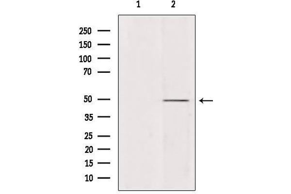 ATP6V1C2 antibody  (Internal Region)