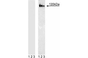 Western blot analysis of c-Cbl (pY774) in human T leukemia. (CBL antibody  (pTyr774))