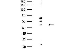 anti-Endonuclease VIII-Like 1 (NEIL1) (Internal Region) antibody