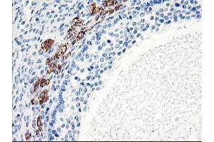 Immunohistochemistry (IHC) image for anti-ELK3, ETS-Domain Protein (SRF Accessory Protein 2) (ELK3) antibody (ABIN1498005) (ELK3 antibody)