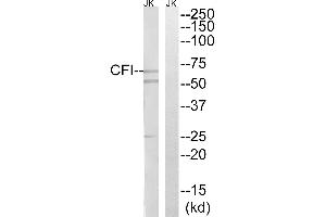 Western blot analysis of extracts from Jurkat cells, using CFI antibody. (Complement Factor I antibody)