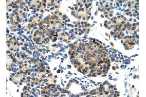 ZNF555 antibody was used for immunohistochemistry at a concentration of 4-8 ug/ml to stain Epithelial cells of pancreatic acinus (arrows) in Human Pancreas.