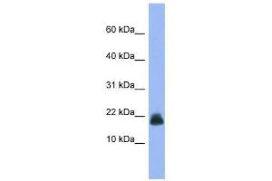 Western Blot showing Cst6 antibody used at a concentration of 1-2 ug/ml to detect its target protein. (CST6 antibody  (Middle Region))